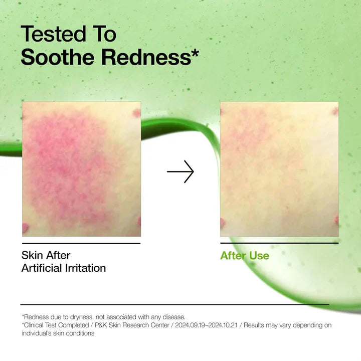 Anua Azelaic Acid 10 Hyaluron Redness Soothing Serum β 30ml | korea