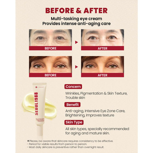 SEOUL 1988 Eye Cream: Retinal Liposome 4% + Fermented Bean [30ml]